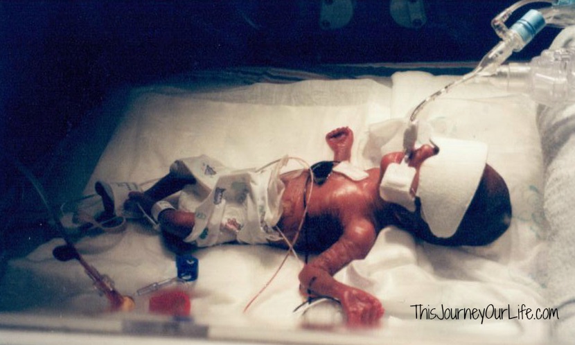 A timeline (in pictures) of our baby’s first weeks in the NICU